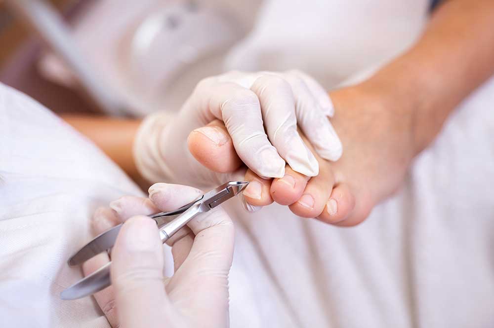 Sorgfältige Behandlung eines Zehennagels
